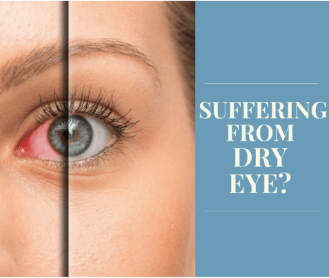 Woman suffering from dry eye syndrome