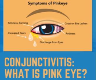 Pink eye: What are the first symptoms?