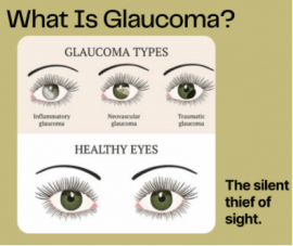 What is Glaucoma?